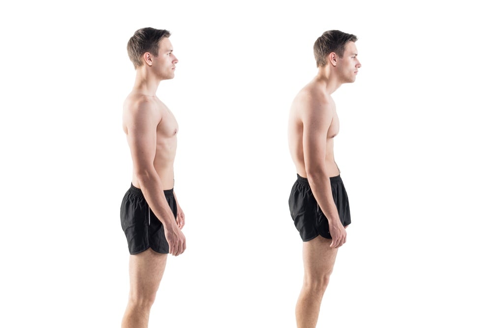 Fix Your Posture in 30 Days! - The Ultimate Guide!